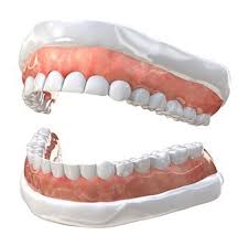 انواع قالب گیری در دندان پزشکی