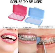 انواع موم های دندان پزشکی