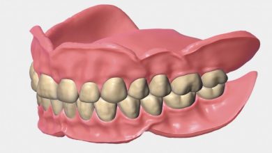 پروتز دندان و انواع آن