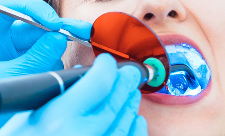 لایت کیور دندانپزشکی چیست؟
