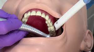 دستگاه ساکشن دندانپزشکی شامل چه قسمت هایی است؟