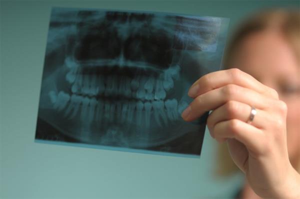 فیلم رادیوگرافی در دندان پزشکی